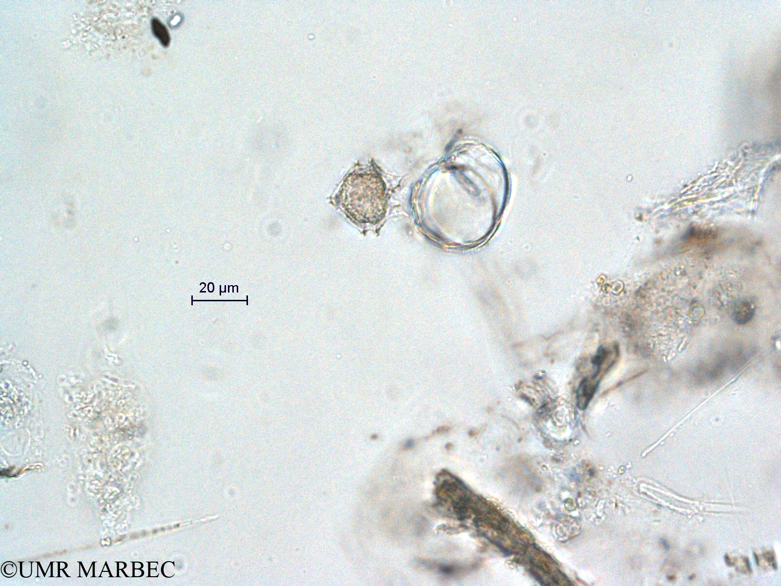 phyto/Scattered_Islands/all/COMMA April 2011/Protoperidinium sp24 (ancien Protoperidinium sp10-6)(copy).jpg